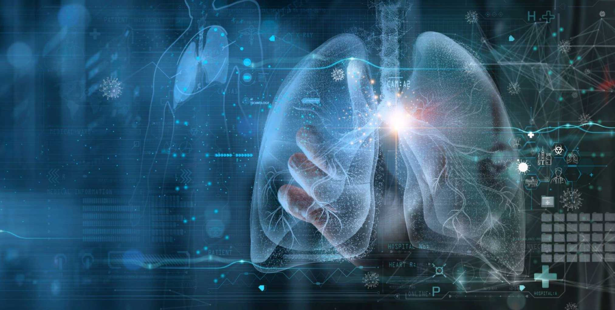 detection-of-lung-diseases-through-X-ray-images